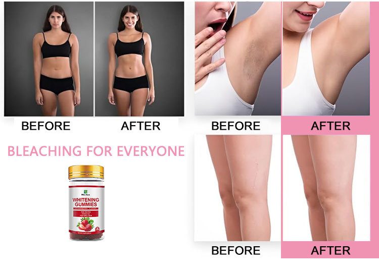 R36 Whitening Gummies - Image 5